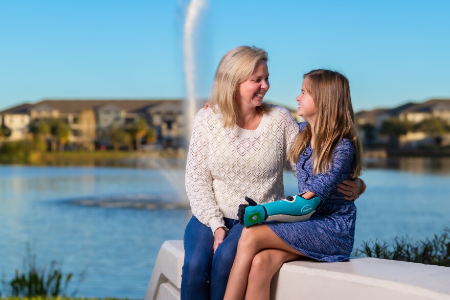 (Right) Eloise Bayliss, 12, sits with her mother, Elizabeth Bayliss after receiving new art attachments for her prosthetic arm stylized with inspiration from Disney's "Moana 2." The arm is from the company Open Bionics.