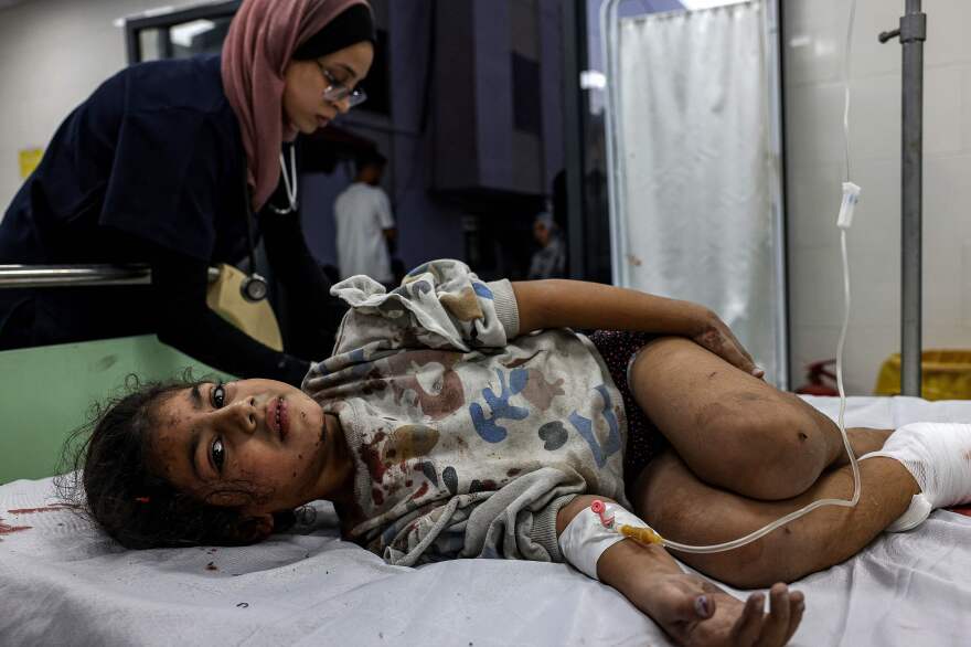 Thurs., Nov. 9: An injured Palestinian girl receives treatment at the Kuwaiti Hospital in Rafah in the southern Gaza Strip.