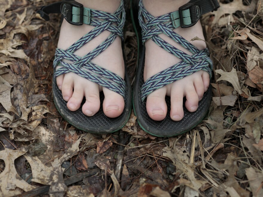 Oakley shows the toe on her right foot that a snakebite deformed when she was hiking at an Illinois summer camp in July 2018. These were the same shoes she wore when she was bitten.