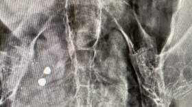 The image is a black and white x-ray showing large lead fragments within a condor's stomach