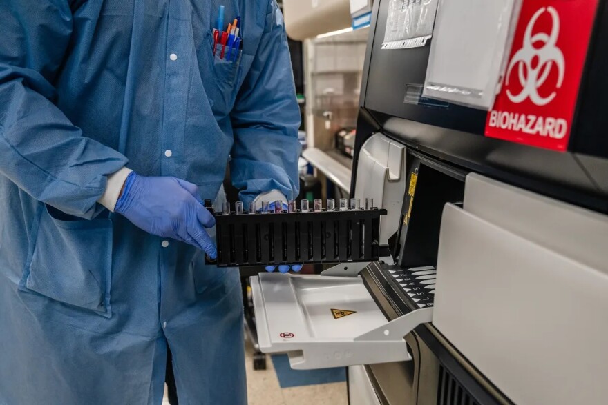Lab Assistant Abraham Jimenez loads blood samples for automated serology testing for measles immunity status at the Los Angeles County Department of Public Health laboratory in Downey on Feb. 26, 2026.