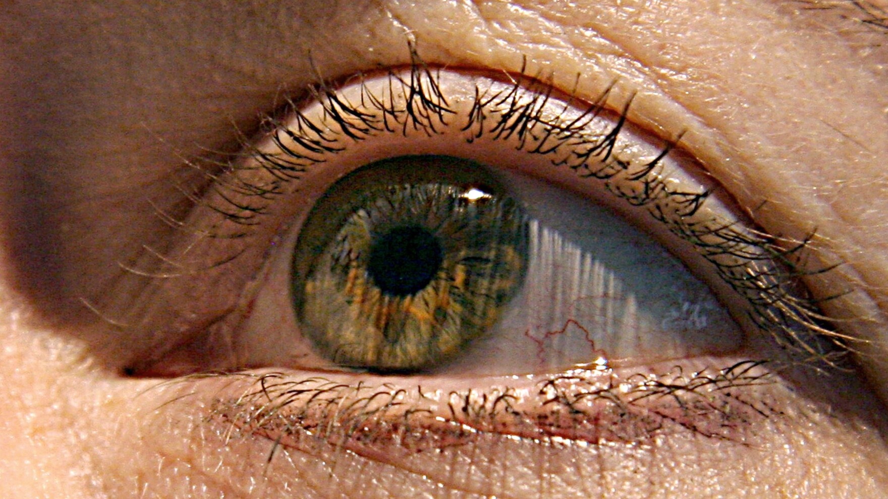 Doctors Stumped By Rare Eye Cancer Cases In North Carolina Alabama Doctors Stumped By Rare Eye Cancer Cases In North Carolina Alabama