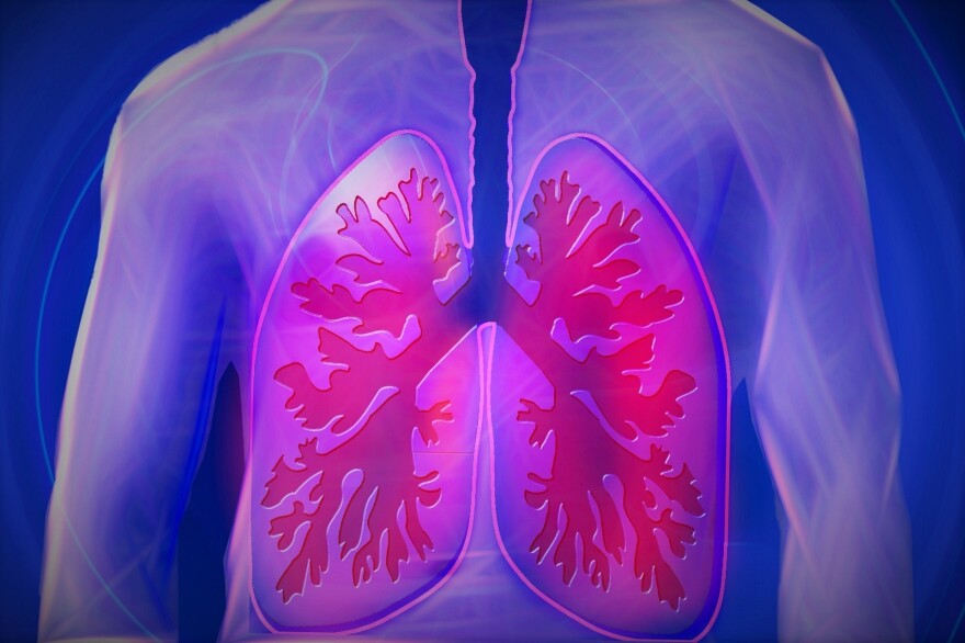  The annual American Lung Association (ALA) State of Lung Cancer report shows the five-year survival rate for people living with lung cancer nationally is improving.