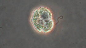 A single-cell of the algae species Karenia brevis, which causes Florida red tide.