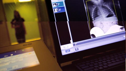 A radiology technician looks at a chest X-ray of a child suffering from flu symptoms at Upson Regional Medical Center in Thomaston, Georgia. (David Goldman/AP)