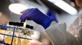 A microbiologist works with tubes of bacteria samples in an antimicrobial resistance and characterization lab within the Infectious Disease Laboratory at the Centers for Disease Control and Prevention in Atlanta in 2013. (David Goldman/AP)