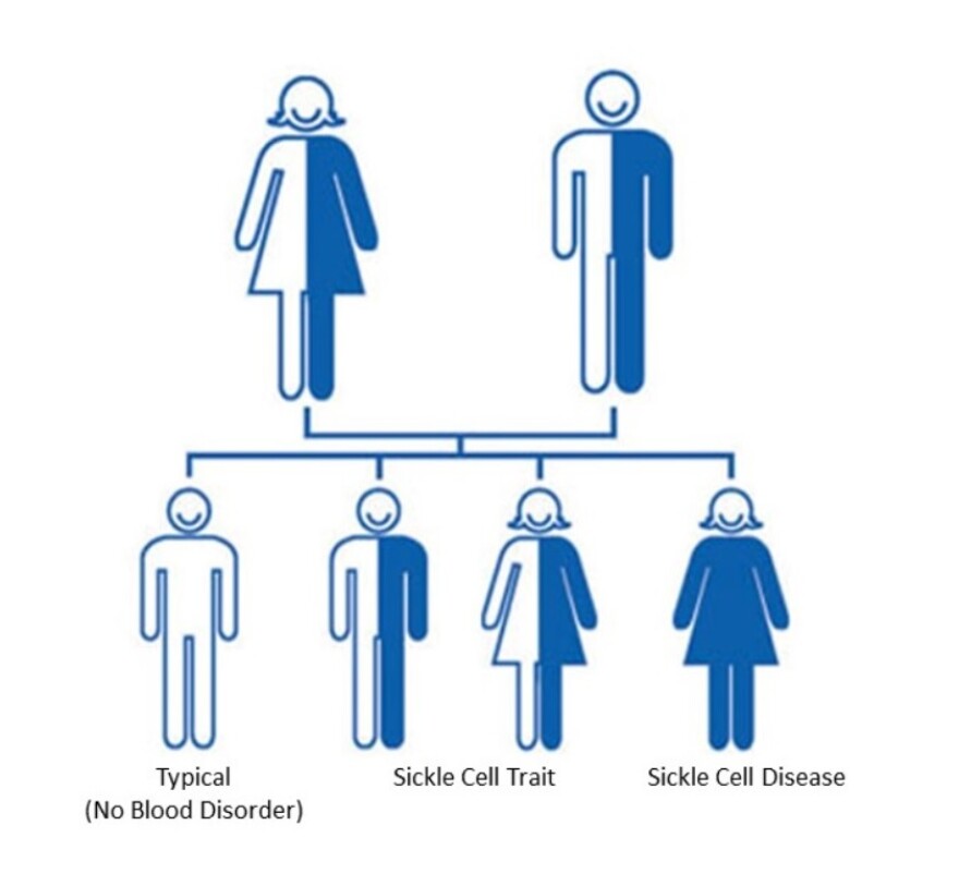 A graphic from the Centers for Disease Control and Prevention explaining how people can inherit the sickle cell gene, and either carry the sickle cell trait or develop sickle cell disease.