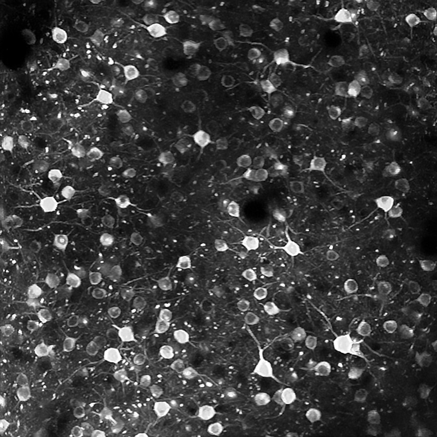 A snapshot of the mouse visual cortex at the cellular level, captured by two-photon microscopy.