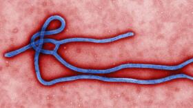 Fears over Ebola have prompted warning overs Ebola-related investment scams.