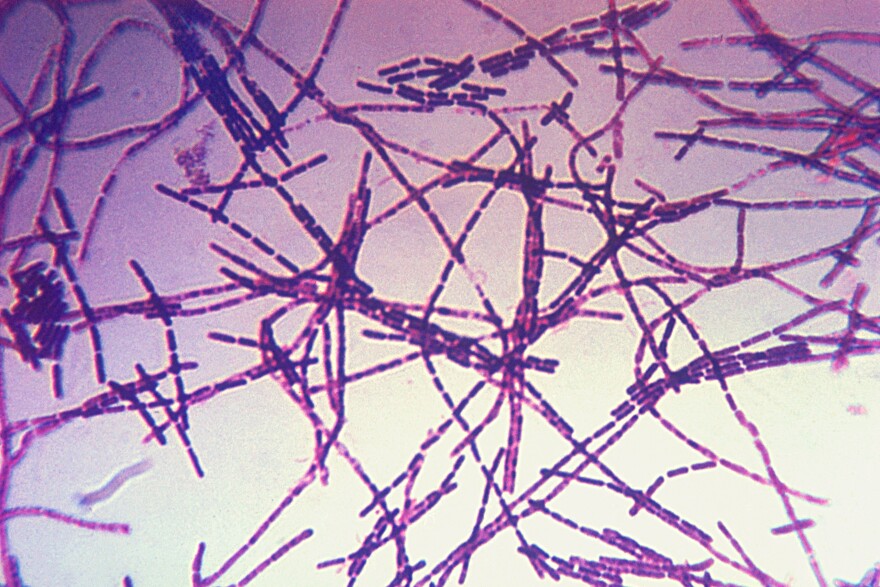 A photomicrograph of Bacillus anthracis bacteria using Gram-stain technique.