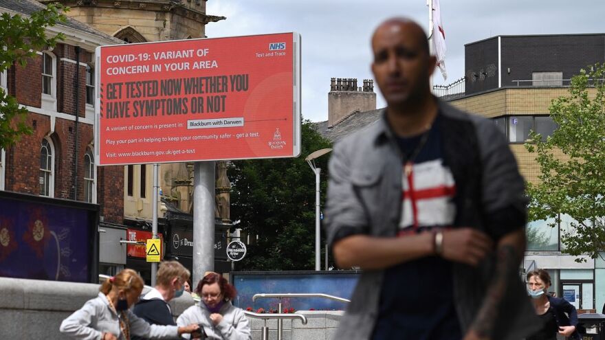 Oli Scarff/AFP via Getty Images