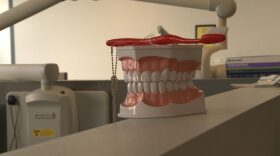 Teeth Model