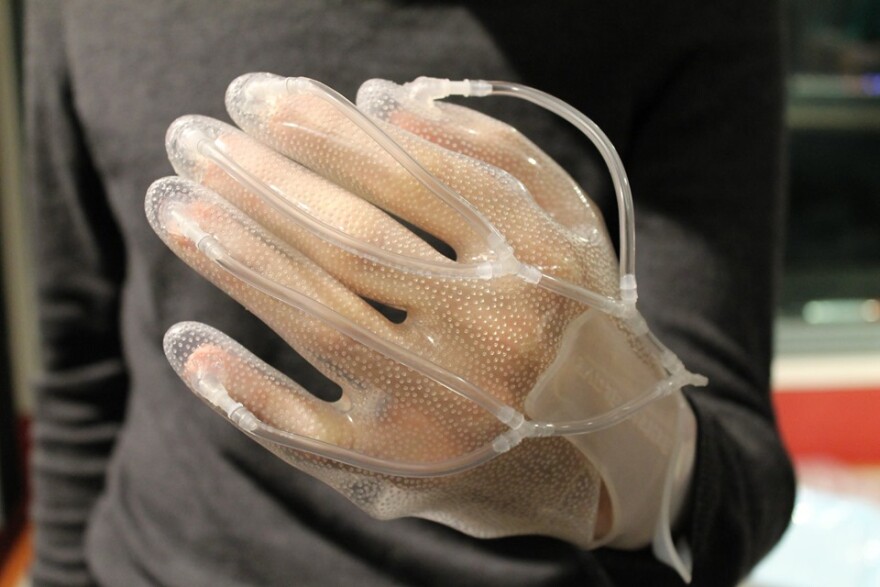 Bioengineered Glove Offers New Kind Of Healing For Hand Wounds KERA News bioengineered-glove-offers-new-kind-of-healing-for-hand-wounds-kera-news