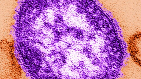 FILE - This undated image made available by the Centers for Disease Control and Prevention on Feb. 4, 2015 shows an electron microscope image of a measles virus particle, center.