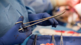 Surgical instruments are used during a surgery at MedStar Georgetown University Hospital in Washington D.C., in June 2016. (Molly Riley/AP)