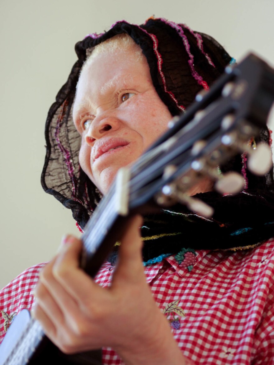 Thereza Phinias, a member of the Tanzania Albinism Collective, wrote a song called "Happiness."