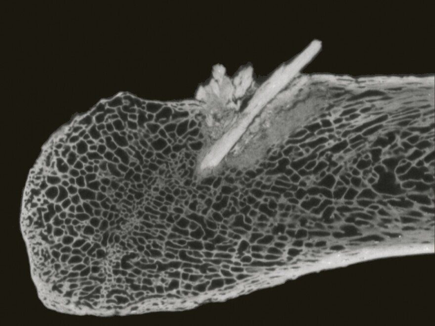 <p>This CT scan image shows a section of mastodon rib where researchers found a spear point lodged in the bone. The spear would have passed through more than 10 inches of hide, tissue and muscle.</p>