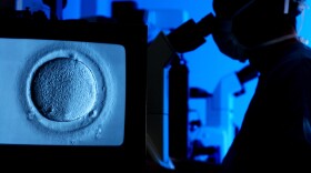A doctor uses a microscrope to view a human egg during in vitro fertilization (IVF), which is used to fertilize eggs that have been frozen.