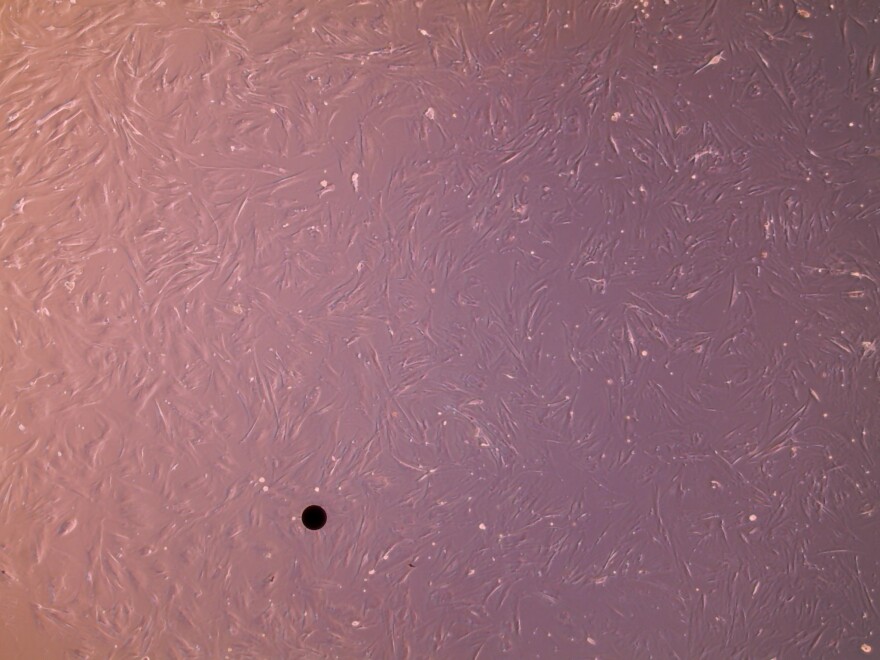 A microscopic image of a dolphin's skin cells. The black dot is a polyethylene microplastic sphere. In other words, a piece of plastic with a width of a human hair.