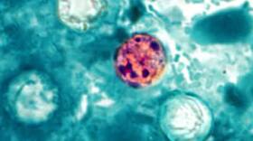 A microscope image shows an oocyst of Cyclospora cayetanensis, the microscopic parasite that causes cyclosporiasis.
