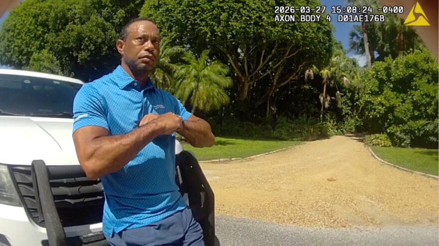 Tiger Woods in a blue polo shirt performs a field sobriety test while leaning on a white SUV 