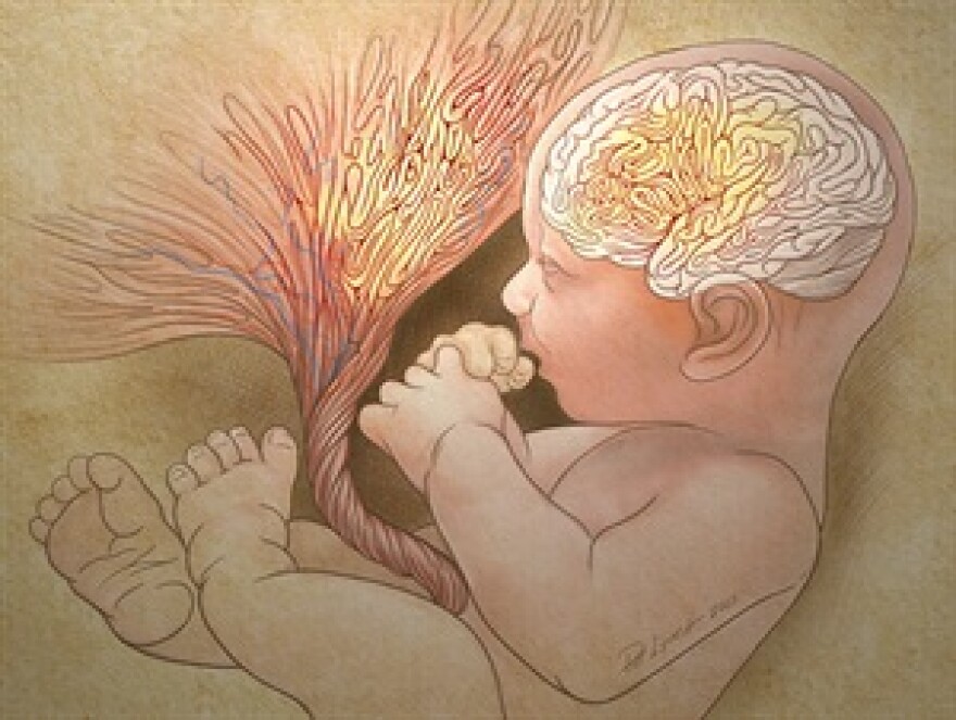 Yale researchers are looking at abnormal folds in the placenta.