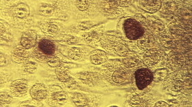 This 1975 microscope file image made available by the Centers for Disease Control and Prevention shows Chlamydia trachomatis bacteria magnified 200X.