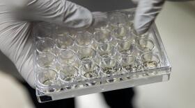 A laboratory testing tray at Harvard Medical School. (Robin Lubbock/WBUR file)