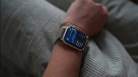 Apple watch on a person's arm showing sleep info on the face of the watch 