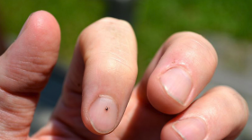 This tick is about the size of a sesame seed.