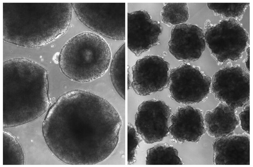 Compared with brain organoids grown from ordinary human cells (left), the organoids with the Neanderthal gene variant (right) have a rough outer layer.