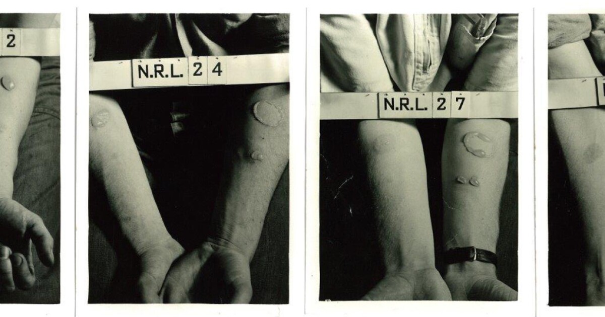 Secret World War II Chemical Experiments Tested Troops By Race