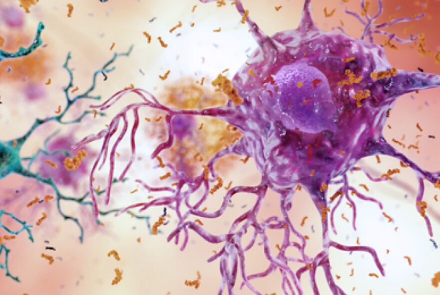 Rochester pharmaceutical company Vaccinex is testing a drug it says could prevent the brain damage that leads to Alzheimer's disease.