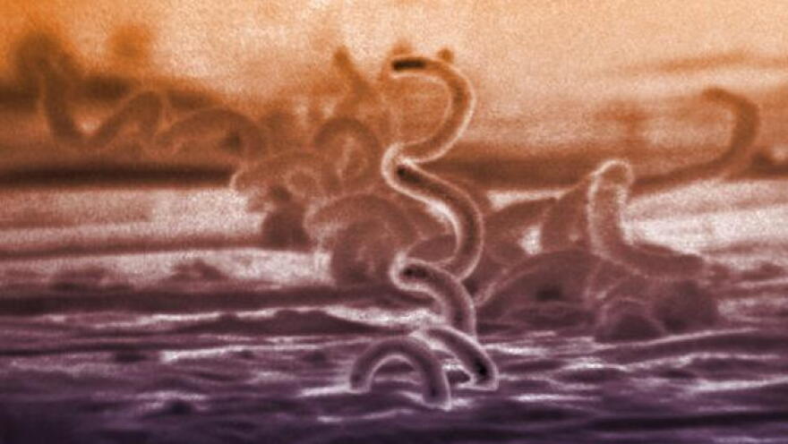 The cause of syphilis is a bacterium called Treponema pallidum.