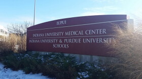 Indiana University's lone capital request to lawmakers for the state budget is money for a new primary medical school campus.