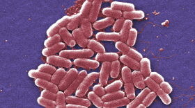 E. coli bacteria is implicated in many cases of urinary tract infection. (Janice Carr/CDC via AP)