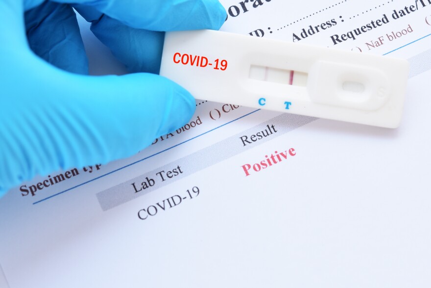 Hey Vermonters Here S What To Do If You Think You Might Have Covid Vermont Public Hey Vermonters Here S What To Do If You Think You Might Have Covid Vermont Public