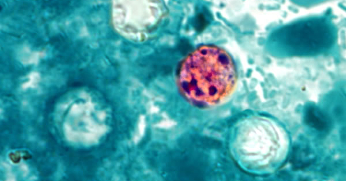 Maryland is keeping a close eye on cyclosporiasis as national cases rise