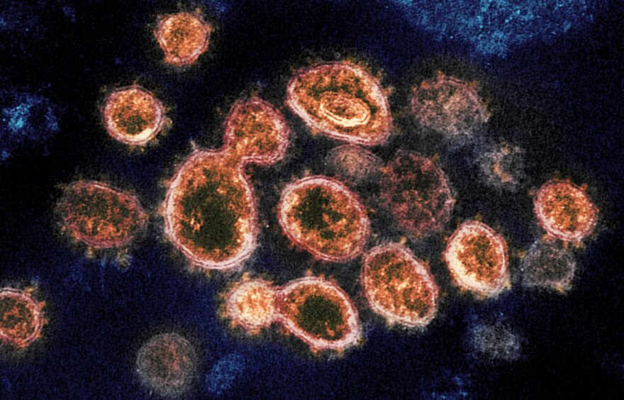 FILE - This 2020 electron microscope image provided by the National Institute of Allergy and Infectious Diseases - Rocky Mountain Laboratories shows SARS-CoV-2 virus particles which cause COVID-19, isolated from a patient in the U.S., emerging from the surface of cells cultured in a lab. Pfizer says its experimental pill for COVID-19 cut rates of hospitalization and death by nearly 90% among patients with mild-to-moderate infections. The company announced Friday, Nov. 5, 2021 it will soon ask the U.S. Food and Drug Administration and international regulators to authorize its pill, which is taken twice a day for five days. (NIAID-RML via AP)