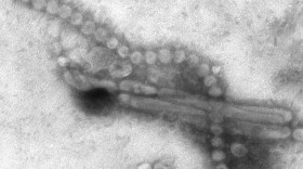 Captured in 2013, this negative stained transmission electron microscopic image captured some of the ultrastructural details exhibited by the influenza A virus.