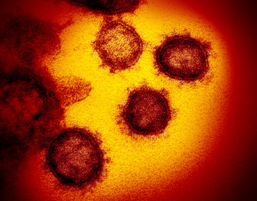 SARS-CoV-2 is shown in this stained transmission electron micrograph.  This specimen was isolated from a patient in the US. Virus particles are shown emerging from the surface of cells grown in the laboratory.