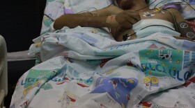 A wounded Syrian, suffering skull, stomach and pancreas injuries from an explosion, in intensive care at Ziv Medical Center in Israel. Hospital staff asked that faces and names not be included to protect the safety of the Syrian patients who could get in trouble with Syrian authorities if it were discovered that they were in Israel.