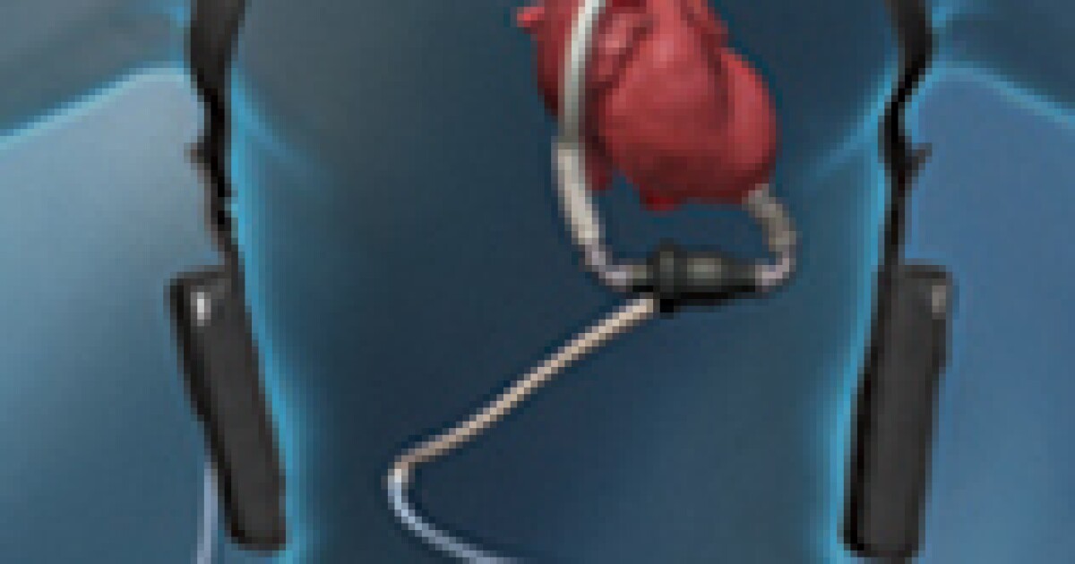 Helping the heart pump but battling blood clots Ideastream Public Media