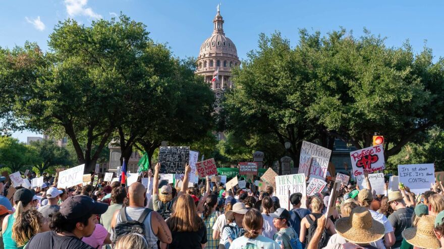 Suzanne Cordeiro/AFP via Getty Images