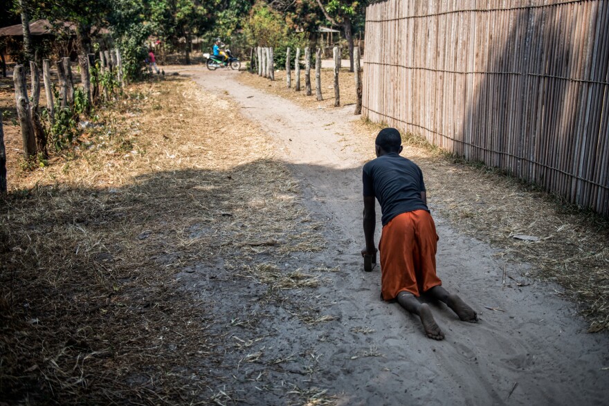 Fils Kunduku, 9, has paralysis in both legs. In Kahemba, many people with konzo crawl through the street because they cannot afford wheelchairs.