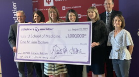 The Alzheimer's Association of Greater Indiana donates funding for the study lead by Indiana University School of Medicine researchers.