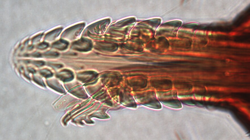 A tick's mouth is covered in hooks that help it dig into the skin and stay attached for several days. This young tick's mouth was photographed under the microscope at San Francisco State University.<strong></strong>