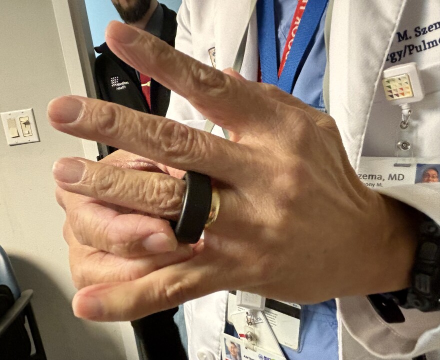 At his office on Long Island, New York, Dr. Anthony Szema models the smart ring that tracks health data for veterans who were exposed to fumes from toxic burn pits overseas.