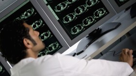 The habit of ordering unneeded tests and treatments drives up medical costs. It's a pattern doctors often learn in medical school and residency.