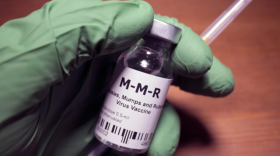 Kansas City-area health officials are on guard as a measles outbreak spreads to more states.